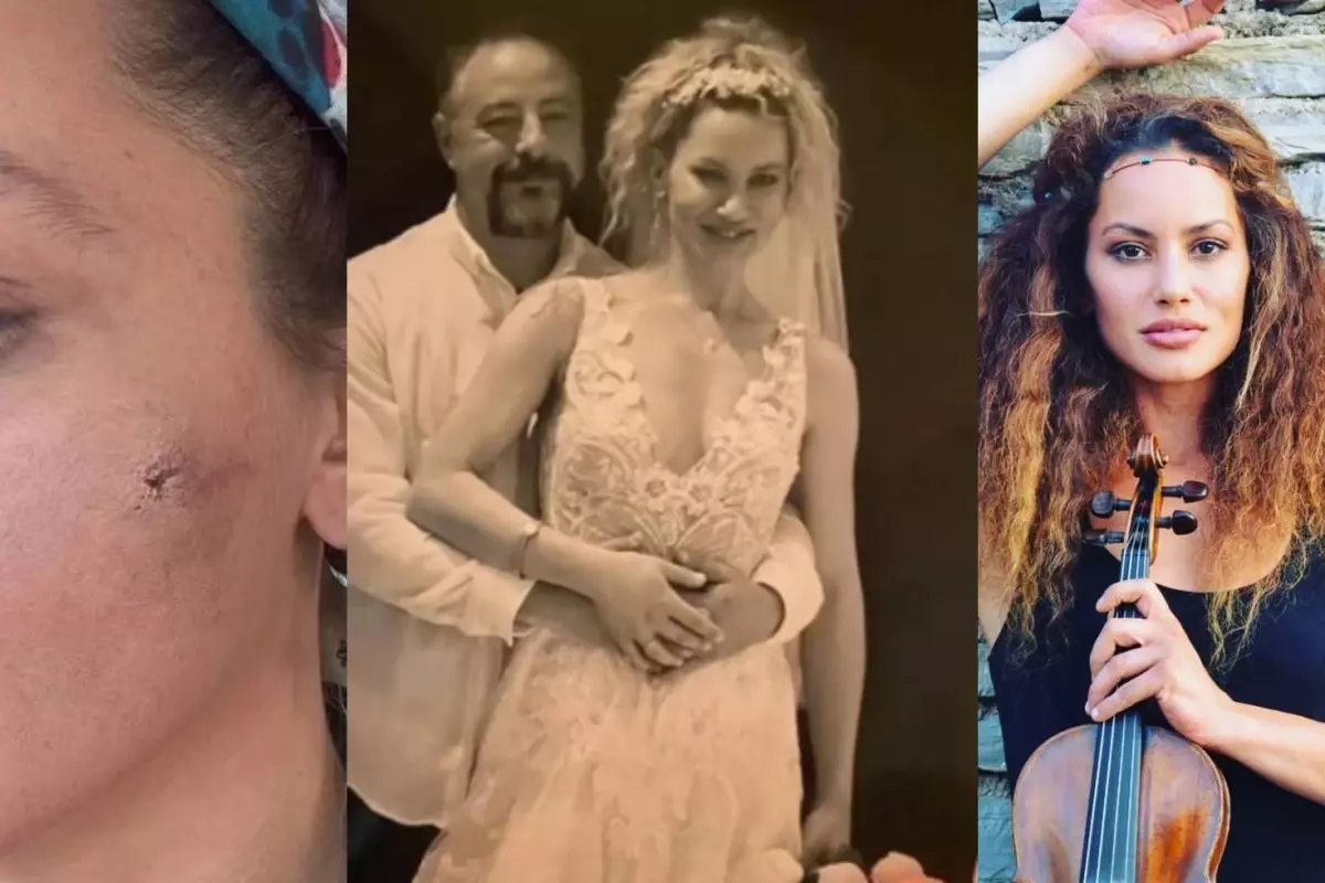 Yıldız Asyalı’nın Korkunç Tehditleri: Koruma Kararı Olmasına Rağmen Eşi Evine Gelmeye Devam Ediyor