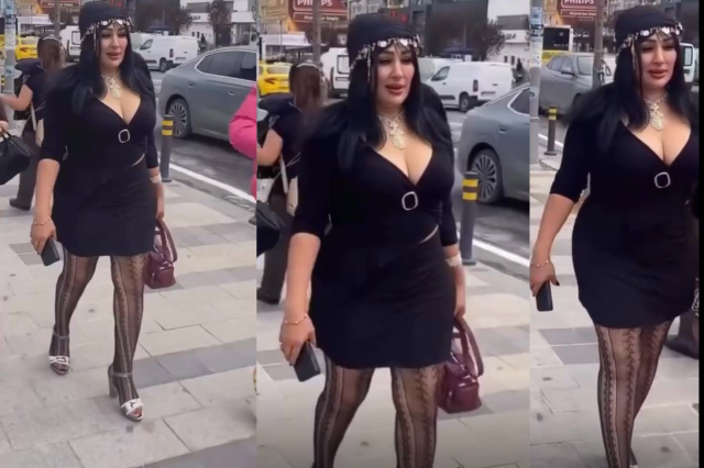 Yazgül Bayat'ın estetik sonrası fotoğrafı