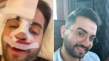 Kadir Ezildi'nin Burun Sargılı Fotoğrafı Yanlış Anlaşıldı: Gerçek 2020 Ameliyatı Açıklandı