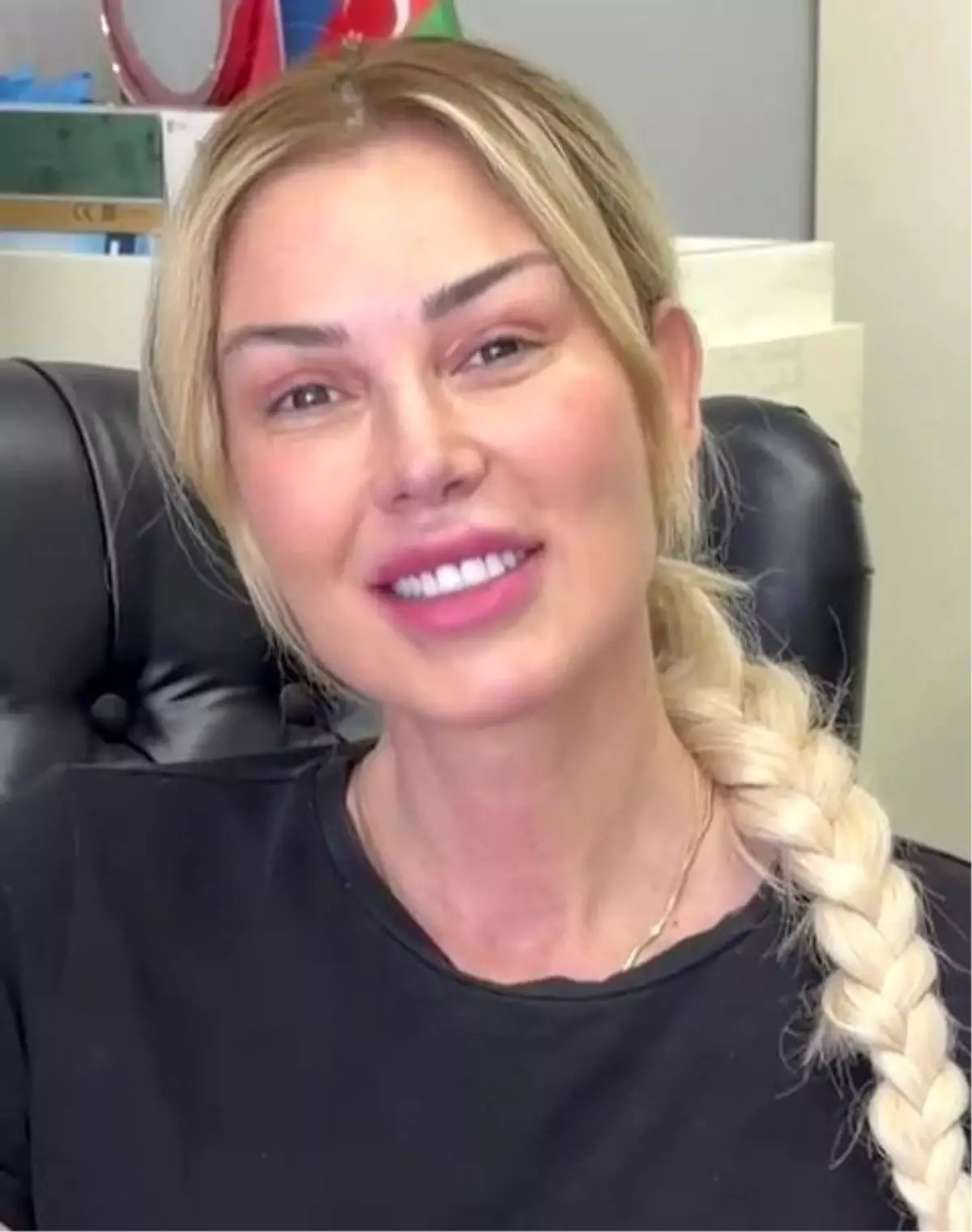 Petek Dinççöz'ün Estetik Sonrası Doğal Görünümü Sosyal Medyada Gündem Oldu