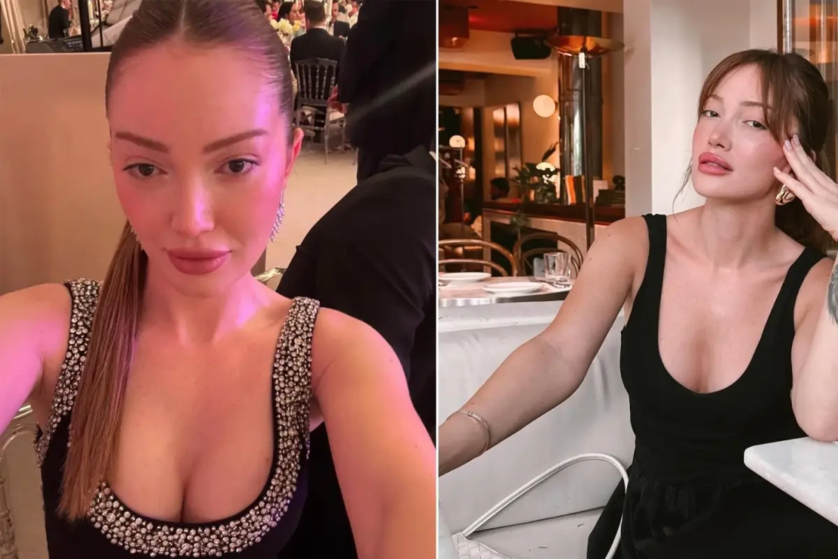 Danla Bilic, Altıncı Estetik Operasyonunu Açıklıyor: Dolgu Sorunları ve Yeni Ameliyat Planı