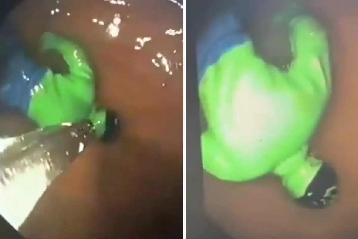 Hulk oyuncağı çıkarılan çocuğun fotoğrafı