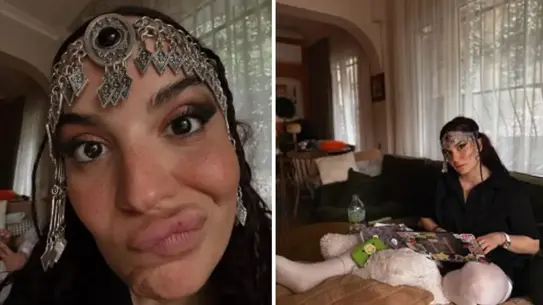 Aslı Bekiroğlu, Yanlışlıkla Bağırsağı Kesilen Ameliyatının Sonrası Sağlık Durumunu Paylaştı